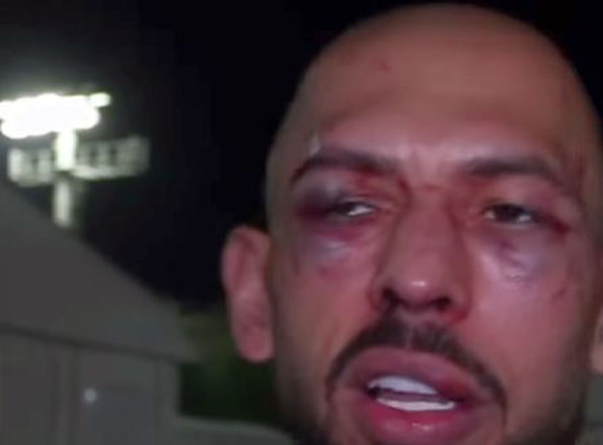 După 5 ani, Andrew Tate a revenit în ring! Un actor l-a umplut de sânge: „Trebuia să-mi înfrunt frica”