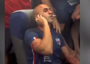 Atenție, imagini dure! » Clipe de groază, autocarul echipei atacat în trafic, 6 fotbaliști răniți! „Veți aștepta să moară cineva?”