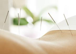 Înțelege conexiunea dintre corp și spirit prin acupunctură !
