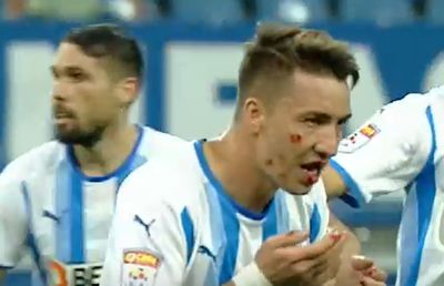 A venit verdictul în cazul accidentării lui Mateiu » Dorința mijlocașului oltean după intrarea horror a lui Izata