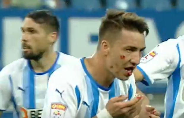 A venit verdictul în cazul accidentării lui Mateiu » Dorința mijlocașului oltean după intrarea horror a lui Izata