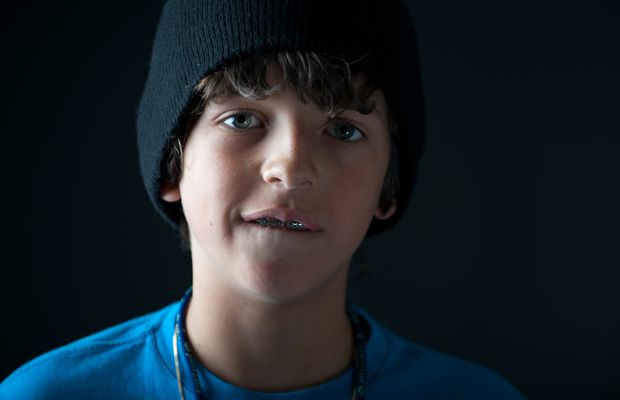 Aparatele dentare și sporturile: cum îți protejezi dantura în timp ce te joci