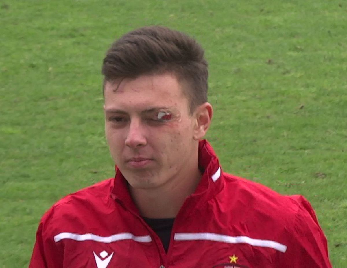 FOTO Metalogobus - Dinamo, 3 detalii, accidentări, sânge, ambulanța pe teren 22.11.2022