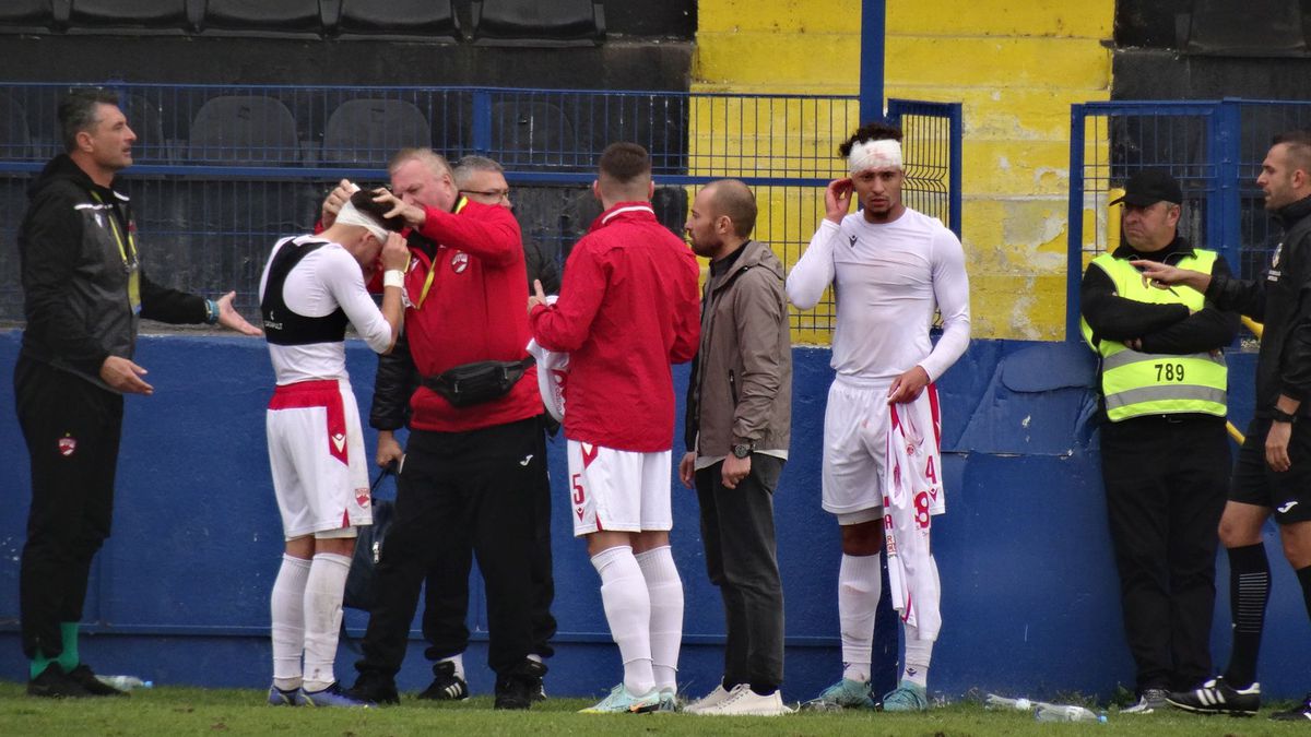 FOTO Metalogobus - Dinamo, 3 detalii, accidentări, sânge, ambulanța pe teren 22.11.2022