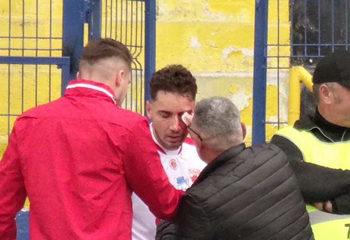 FOTO Metalogobus - Dinamo, 3 detalii, accidentări, sânge, ambulanța pe teren 22.11.2022