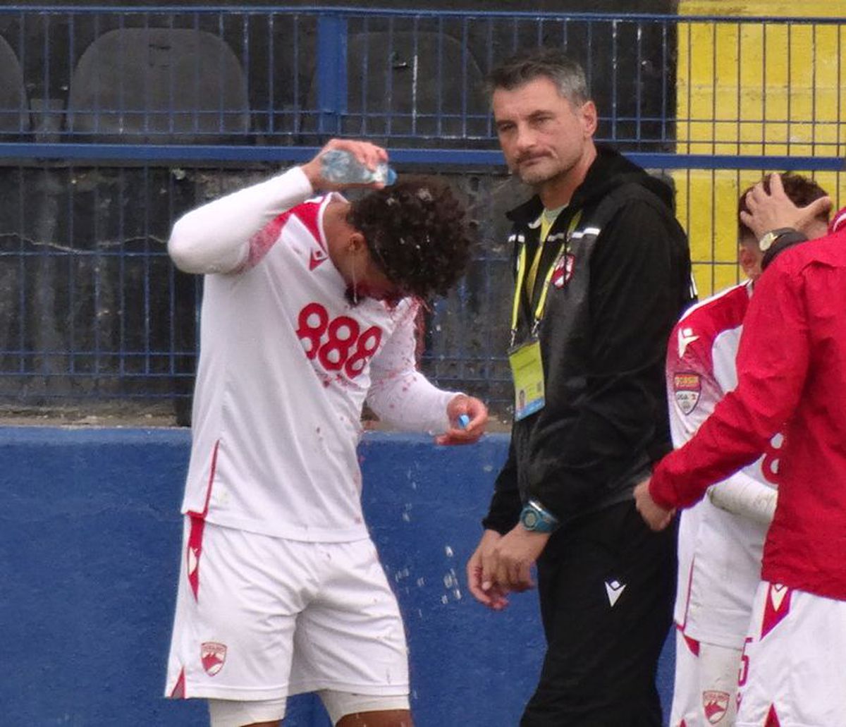 FOTO Metalogobus - Dinamo, 3 detalii, accidentări, sânge, ambulanța pe teren 22.11.2022