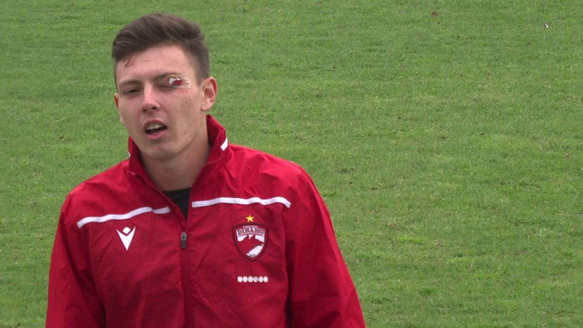 FOTO Metalogobus - Dinamo, 3 detalii, accidentări, sânge, ambulanța pe teren 22.11.2022