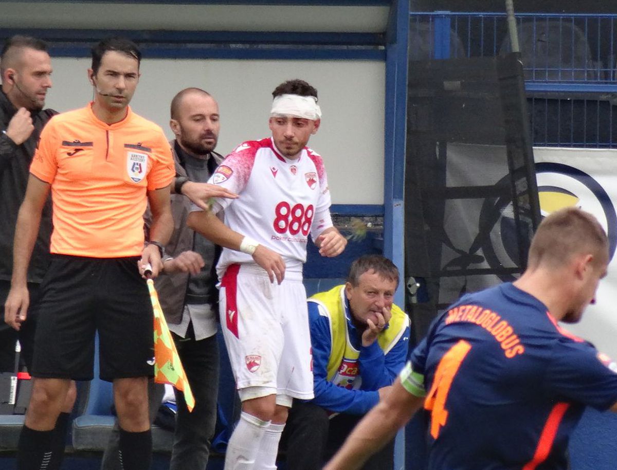 FOTO Metalogobus - Dinamo, 3 detalii, accidentări, sânge, ambulanța pe teren 22.11.2022