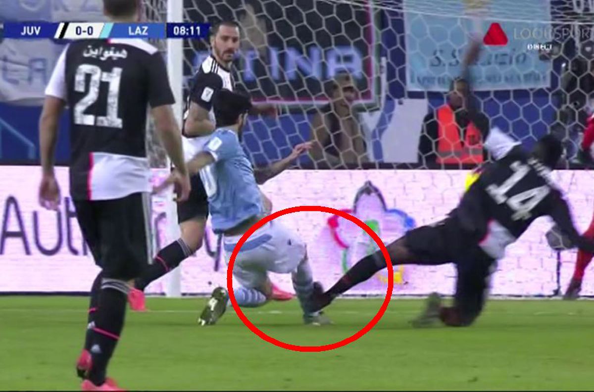 FOTO Intrare horror în Juventus - Lazio! Putea să îi rupă piciorul, dar arbitrul nu a dat nici măcar fault