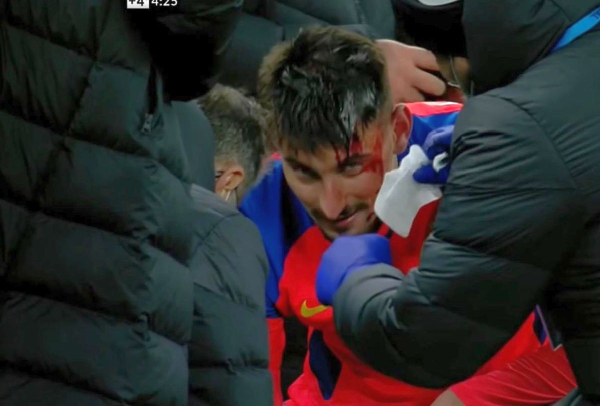 FCSB - CFR CLUJ 3-3. Iulian Cristea descrie imaginile dramatice din prelungiri: „Colegii au sărit pe mine, eu deja simțeam sângele pe mână”