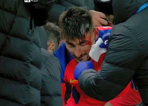 FCSB - CFR CLUJ 3-3. Iulian Cristea descrie imaginile dramatice din prelungiri: „Colegii au sărit pe mine, eu deja simțeam sângele pe mână”