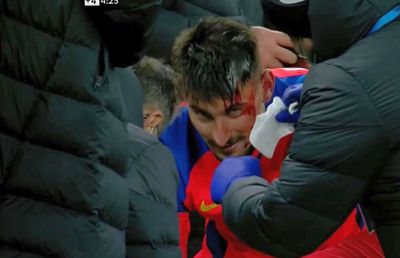 FCSB - CFR CLUJ 3-3. Iulian Cristea descrie imaginile dramatice din prelungiri: „Colegii au sărit pe mine, eu deja simțeam sângele pe mână”