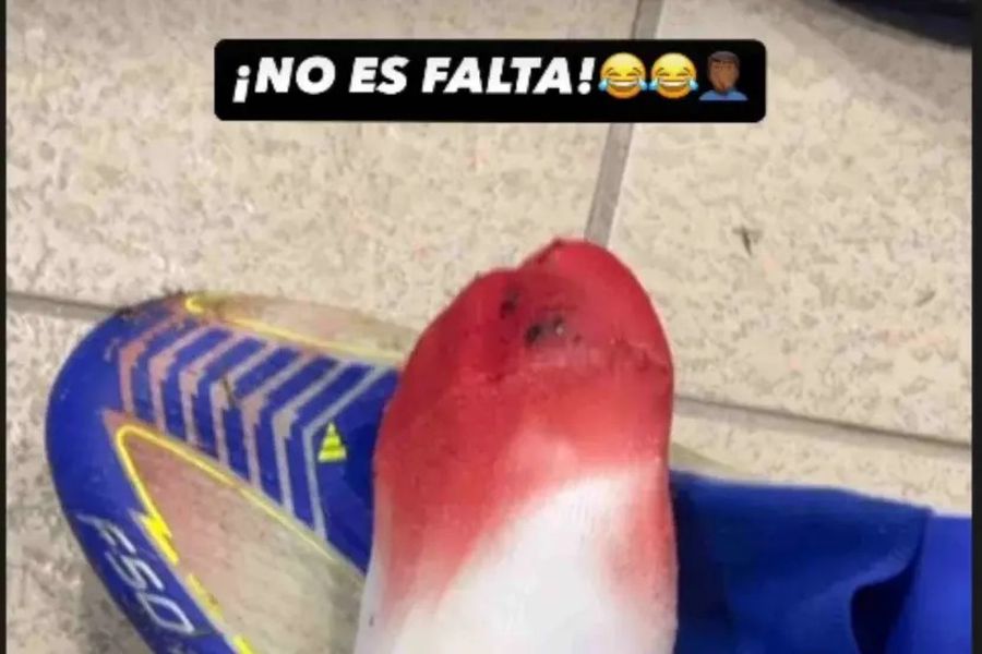 Lamine Yamal, imagine horror cu piciorul său » Ce mesaj a postat după ultima accidentare