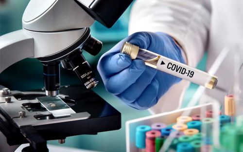 Testarea pentru coronavirus în România