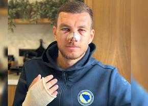 Edin Dzeko, apariție șocantă după ce Mihai Popescu i-a dat un șut în față. Mario Balotelli a intervenit