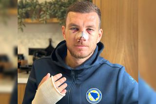 Edin Dzeko, apariție șocantă după ce Mihai Popescu i-a dat un șut în față. Mario Balotelli a intervenit