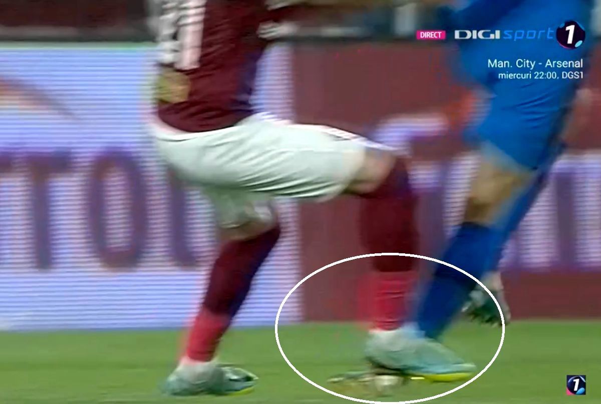 Florinel Coman a apărut cu tibia „împachetată” după Rapid - FCSB. Ironii acide: „Feșnic a arbitrat super! Ați văzut cum am sărit trei metri, nu?”