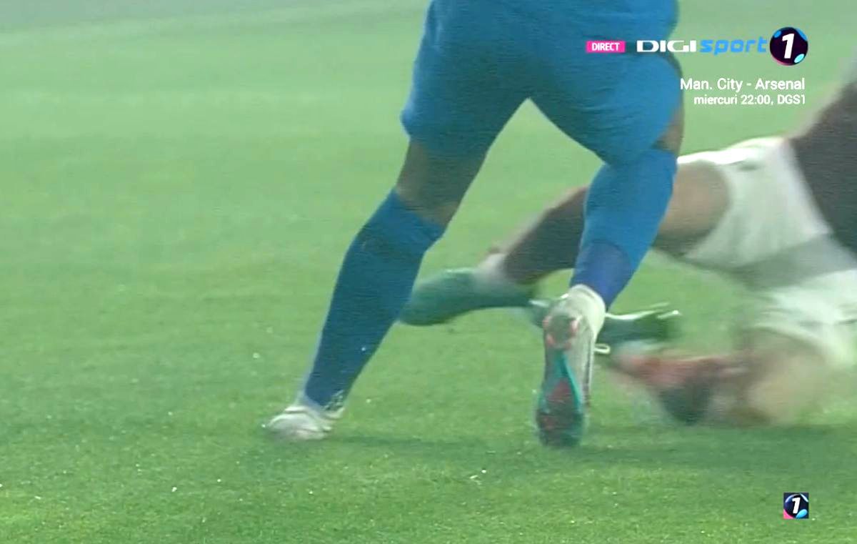 Florinel Coman a apărut cu tibia „împachetată” după Rapid - FCSB. Ironii acide: „Feșnic a arbitrat super! Ați văzut cum am sărit trei metri, nu?”