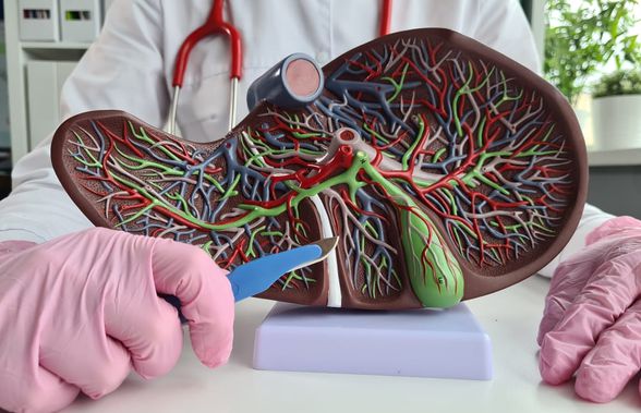 Cum se diagnostichează și cum se tratează hipertensiunea portală?