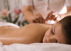 Tot ce trebuie să știi despre acupunctură si tratamentele cu aceasta !