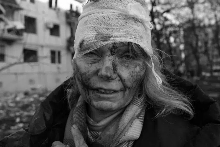 O femeie rănită după ce un bloc din orașul Ciuhuiiv, lângă Harkov, a fost devastat de o rachetă rusească // FOTO: Hepta