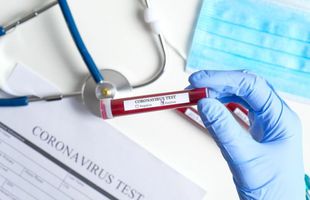 CORONAVIRUS. România începe testarea în masă. Vin primele 200.000 de kituri COVID-19 din Coreea