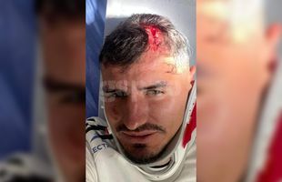 Dinamo recidivează: imagine-șoc cu Romario Benzar după intrarea criminală a lui Abdallah » Diagnosticul pus la spital