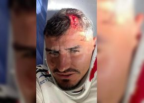Imagine horror cu Romario Benzar după faultul lui Abdallah » Care e starea fundașului + Alți doi de la FC Botoșani au avut de suferit