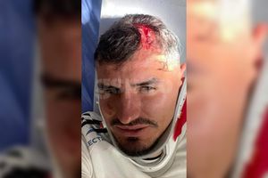 Imagine horror cu Romario Benzar după faultul lui Abdallah » Care e starea fundașului + Alți doi de la FC Botoșani au avut de suferit