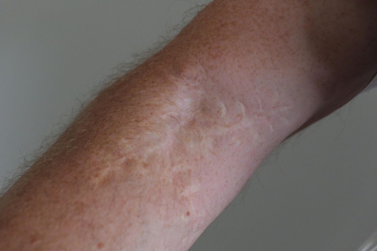 Interviu cu Adnan Guso la Sarajevo