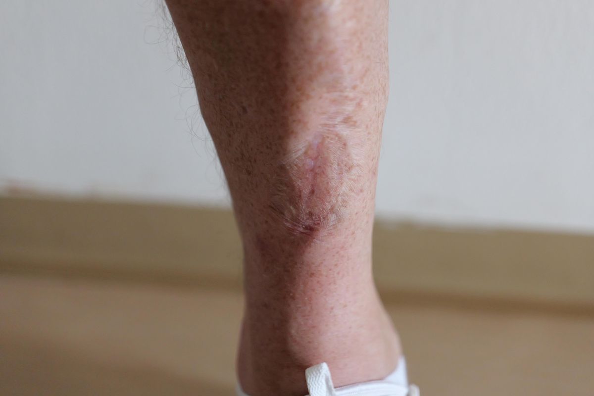 Interviu cu Adnan Guso la Sarajevo