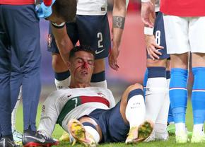 Cristiano Ronaldo și-a spart nasul în meciul Portugaliei + Lovitură de teatru la Zaragoza: Elveția câștigă în Spania » Cum arată clasamentul