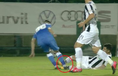ASTRA - POLI IAȘI 4-0. FOTO Imagine șocantă! Cum arată piciorul lui Valentin Gheorghe, după faultul horror: „Eu zic că e de roșu, nu? Voi ce ziceți?”