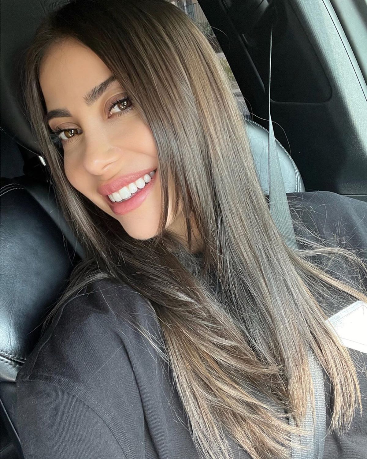 Fotbalistul pe care Becali a luat 2 milioane de euro și-a făcut implant de păr » Imagini spectaculoase: cum arată înainte și după intervenție