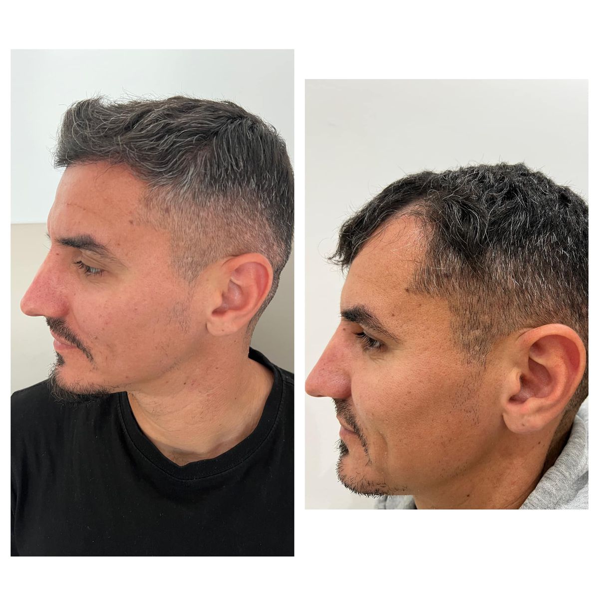 FOTO Romario Benzar, implant de păr și imagini cu Bianca, soția lui