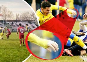 Caz revoltător în România! Fotbalistul cu proteză, care a făcut înconjurul lumii, acuză că a fost umilit în meciul cu echipa care l-a crescut: „«Mânuță», te-a călcat trenul? Băga-mi-aș p**a în mâna ta”