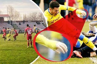 Caz revoltător în România! Fotbalistul cu proteză, care a făcut înconjurul lumii, acuză că a fost umilit în meciul cu echipa care l-a crescut: „«Mânuță», te-a călcat trenul? Băga-mi-aș p**a în mâna ta”