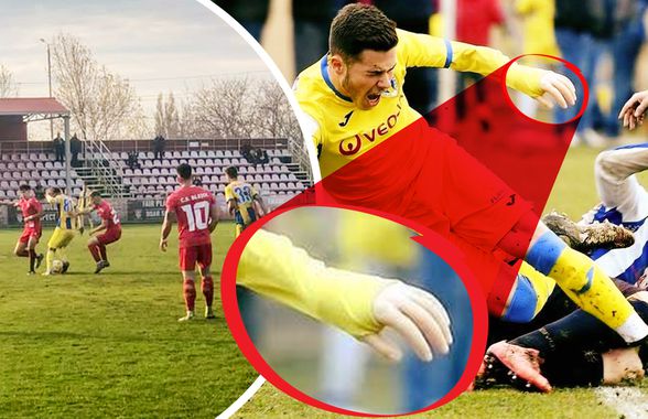 Caz revoltător în România! Fotbalistul cu proteză, care a făcut înconjurul lumii, acuză că a fost umilit în meciul cu echipa care l-a crescut: „«Mânuță», te-a călcat trenul? Băga-mi-aș p**a în mâna ta”