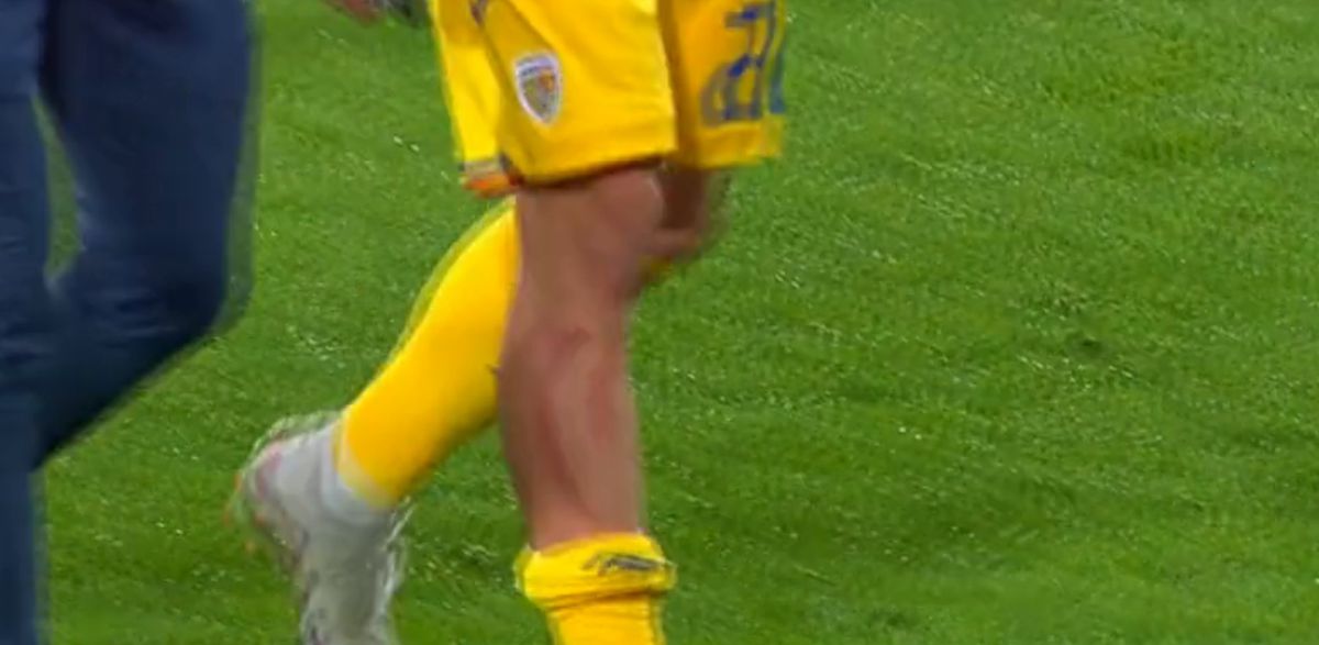 Dennis Man, nervos la pauză! A ieșit șifonat după prima repriză din Andorra - România