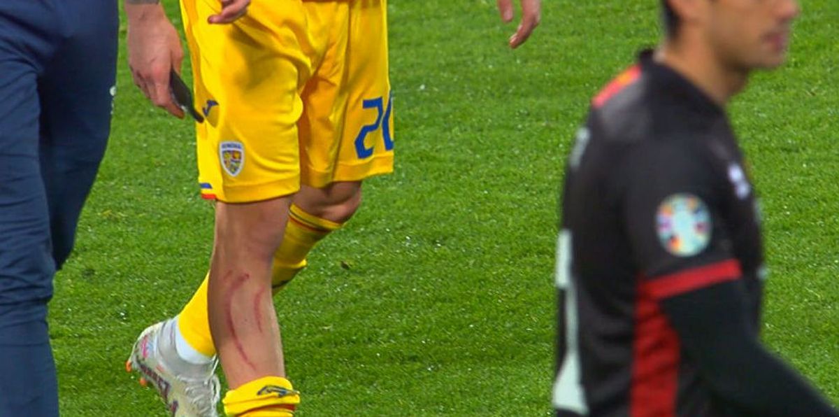 Dennis Man, nervos la pauză! A ieșit șifonat după prima repriză din Andorra - România