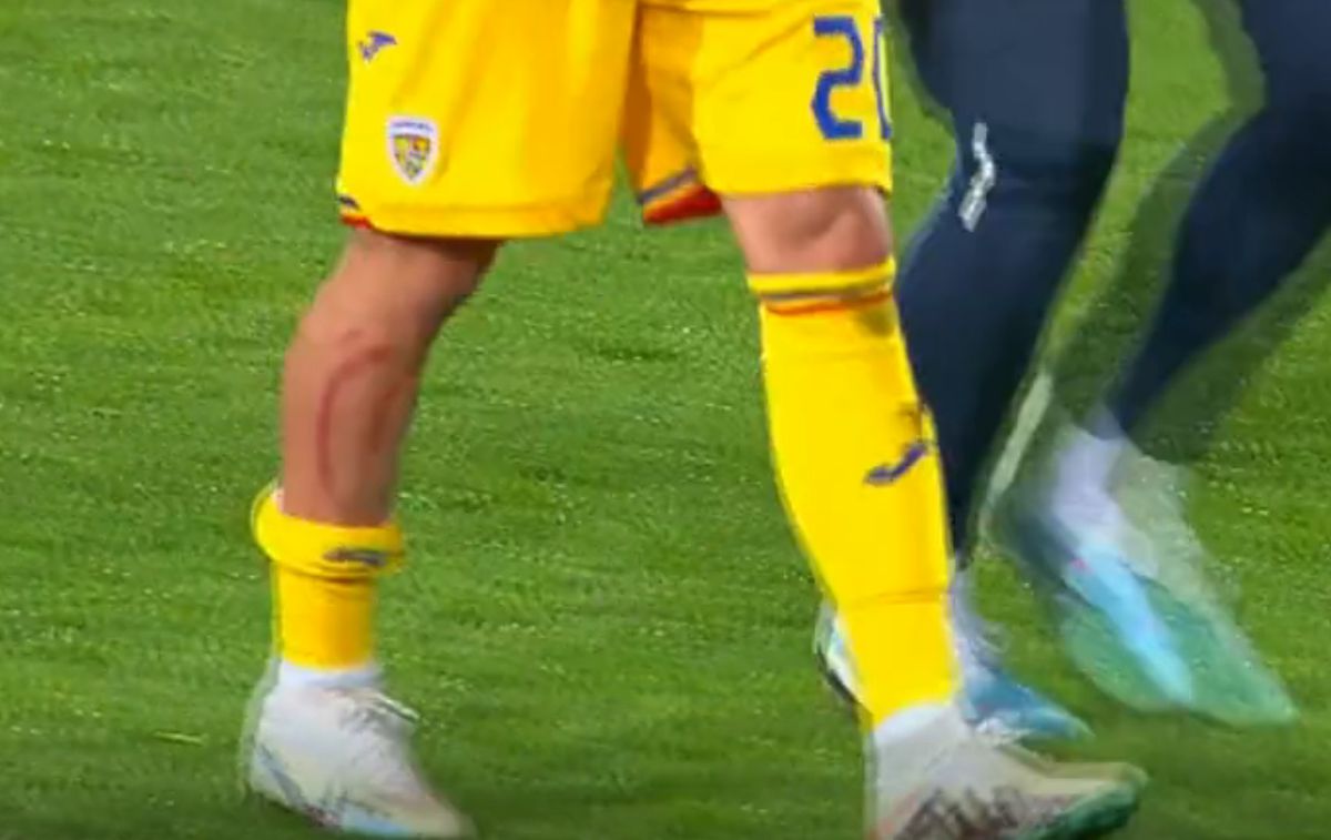 Dennis Man, nervos la pauză! A ieșit șifonat după prima repriză din Andorra - România