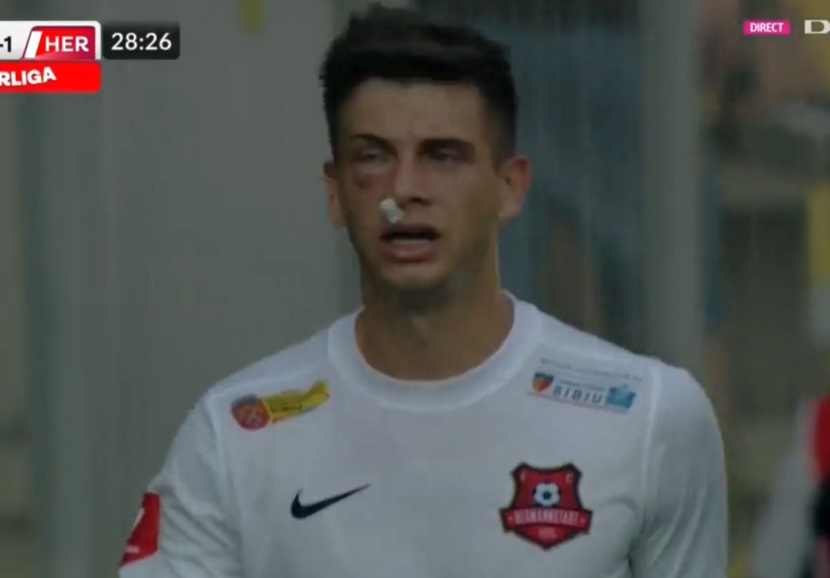 Atenție, imagini dure în Liga 1: hemoragie nazală și hematom pronunțat după o lovitură nesancționată de arbitri