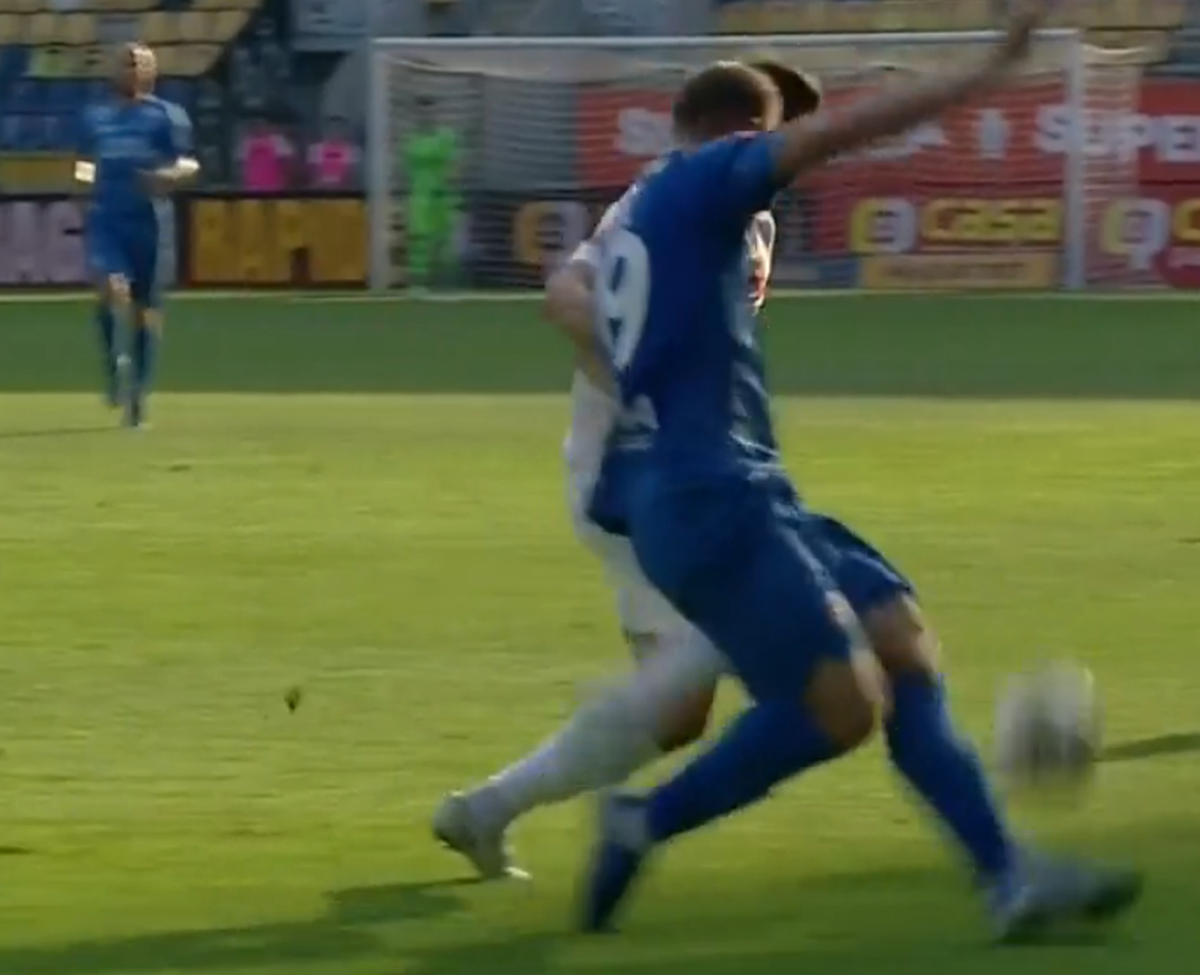 Atenție, imagini dure în Liga 1: hemoragie nazală și hematom pronunțat după o lovitură nesancționată de arbitri