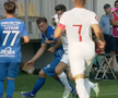 Atenție, imagini dure în Liga 1: hemoragie nazală și hematom pronunțat după o lovitură nesancționată de arbitri