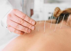 Problemele menstruale își pot găsi tratamentul și prin acupunctură