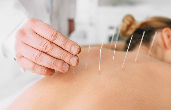 Problemele menstruale își pot găsi tratamentul și prin acupunctură