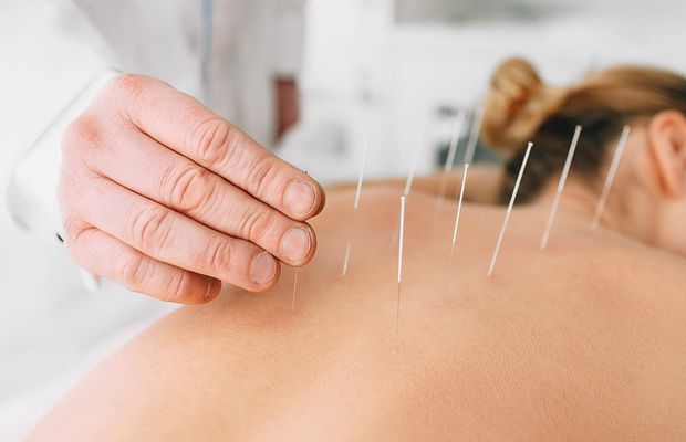 Problemele menstruale își pot găsi tratamentul și prin acupunctură
