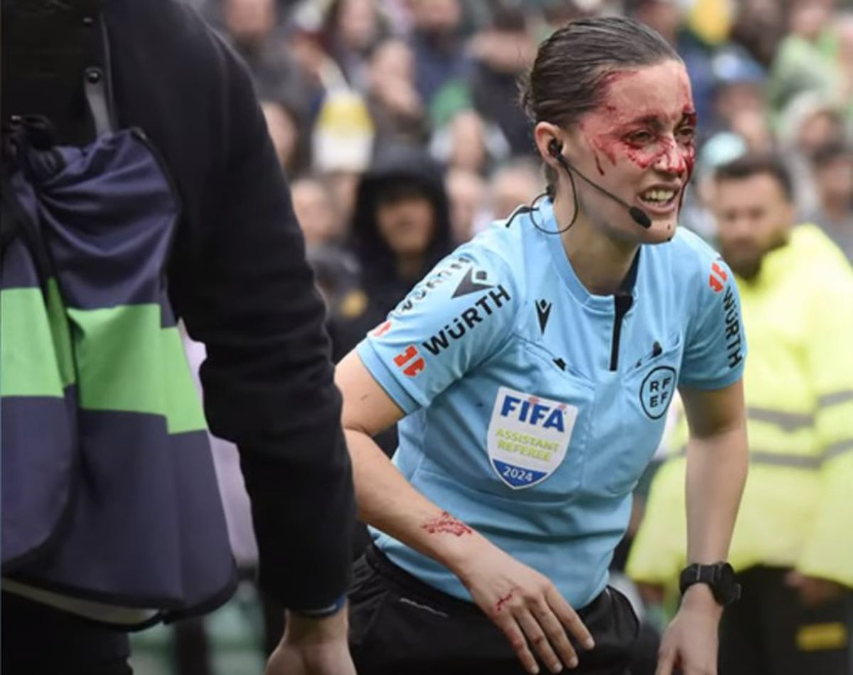 Imagine brutală cu arbitra-asistent din La Liga » Umplută de sânge după o lovitură puternică