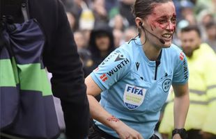 Imagine brutală cu arbitra-asistent din La Liga » Umplută de sânge după o lovitură puternică