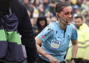 Imagine brutală cu arbitra-asistent din La Liga » Umplută de sânge după o lovitură puternică